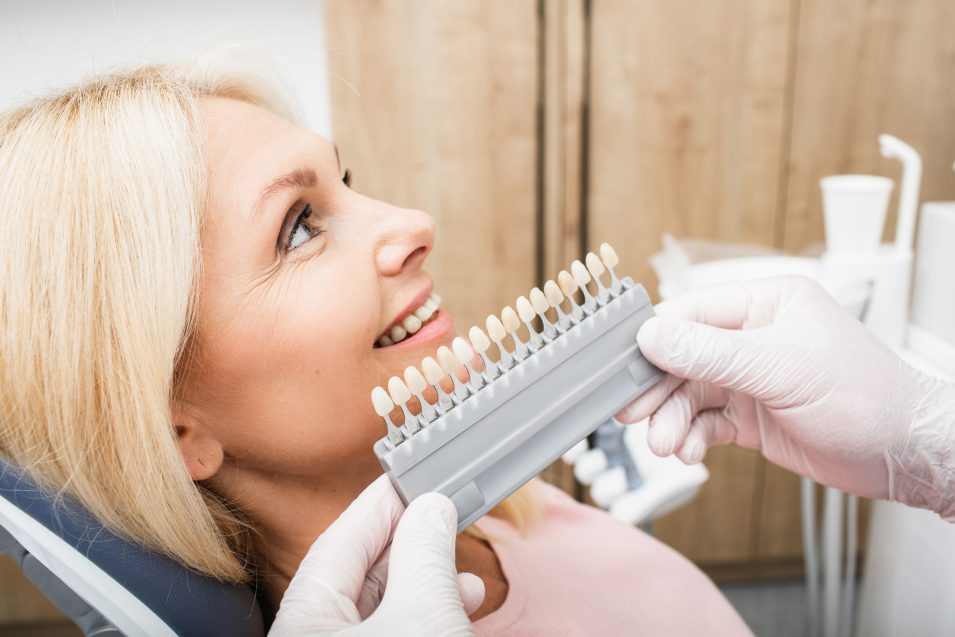Teeth palette with different shades of teeth near female smiling. Stomatology, whitening teeth, tooth implant, veneers, crowns, and dentures