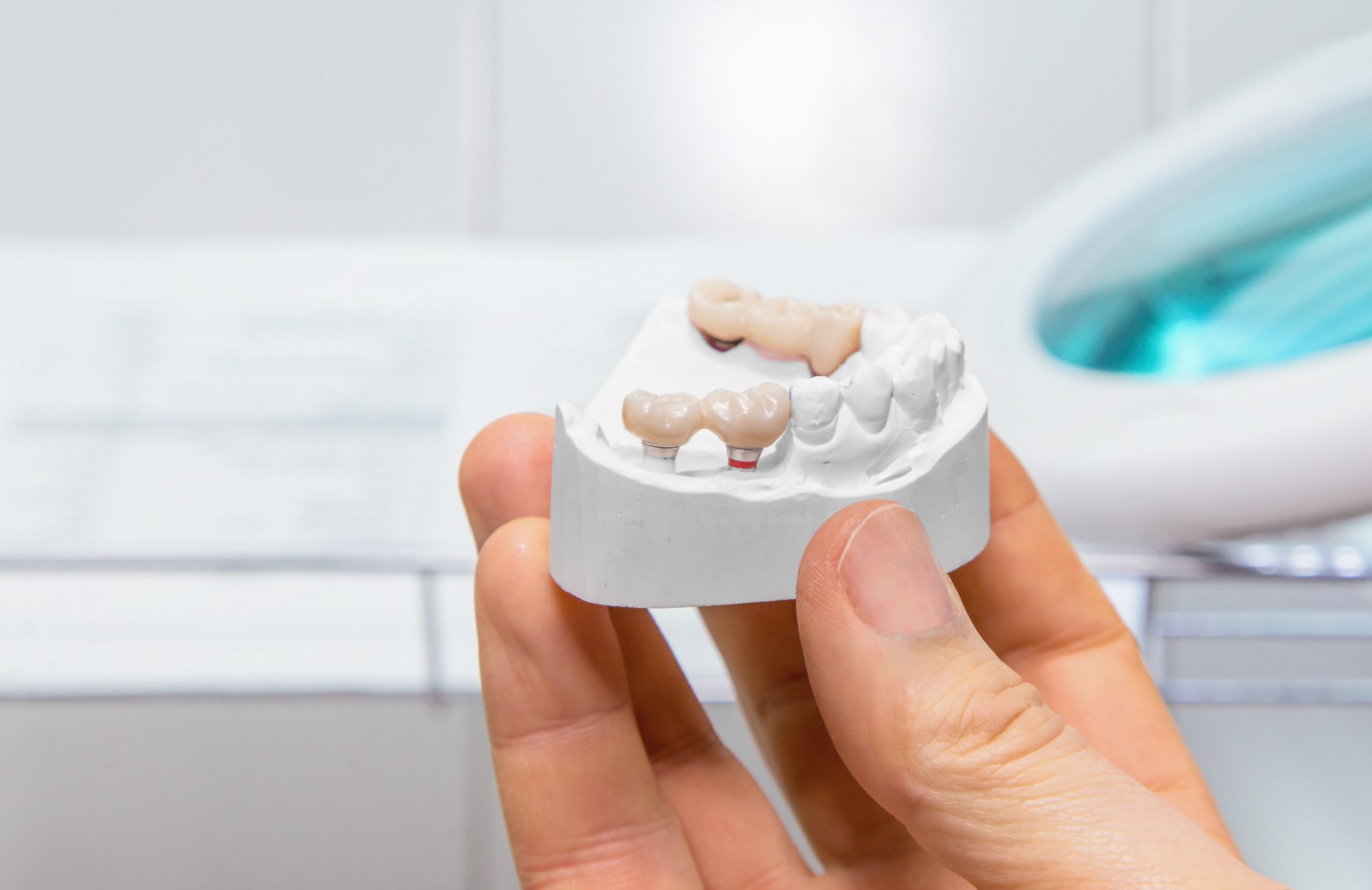 Technical shots of model on a dental prothetic laboratory